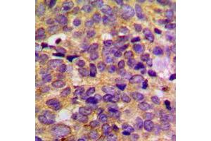 Immunohistochemistry (IHC) image for anti-Protein Kinase, CAMP-Dependent, Regulatory, Type II, beta (PRKAR2B) (Center) antibody (ABIN7296682)