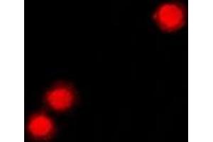 Immunofluorescent analysis of ZNF195 staining in A549 cells. (ZNF195 antibody)