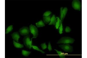 Immunofluorescence of monoclonal antibody to LGALS1 on HeLa cell. (LGALS1/Galectin 1 antibody  (AA 1-135))