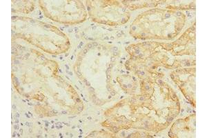 Immunohistochemistry of paraffin-embedded human kidney tissue using ABIN7170164 at dilution of 1:100 (SLC22A8 antibody  (AA 473-542))