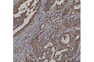 IHC analysis of FATP3/SLC27A3 using anti-FATP3/SLC27A3 antibody (ABIN7600438). (SLC27A3 antibody  (AA 192-683))