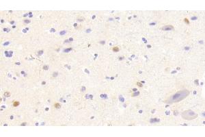 Immunohistochemistry (IHC) image for anti-Acidic (Leucine-Rich) Nuclear phosphoprotein 32 Family, Member A (ANP32A) (AA 2-175) antibody (ABIN7437665)