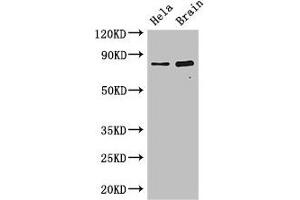 Western Blot Positive WB detected in: Hela whole cell lysate, Mouse brain tissue All lanes: DACH1 antibody at 2. (ING3 antibody  (AA 51-223))