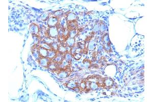 Formalin-fixed, paraffin-embedded human Pancreas stained with CD56 Monoclonal Antibody (SPM128) (CD56 antibody)