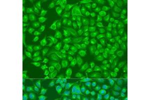 Immunofluorescence analysis of U2OS cells using SLC12A6 Polyclonal Antibody at dilution of 1:100. (SLC12A6 antibody)