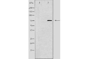 Western blot analysis of extracts from COLO cells using TUBGCP4 antibody. (TUBGCP4 antibody  (Internal Region))