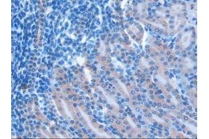 Detection of RSPO1 in Mouse Kidney Tissue using Polyclonal Antibody to R-Spondin 1 (RSPO1) (RSPO1 antibody  (AA 21-135))