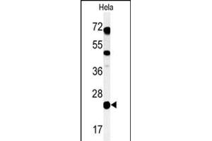 Western blot analysis of C Antibody (C-term) (ABIN650955 and ABIN2840009) in Hela cell line lysates (35 μg/lane). (C16ORF54 antibody  (C-Term))