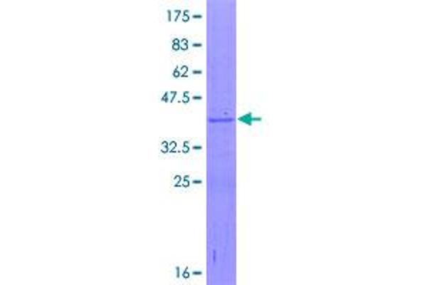 RPL35A Protein (AA 1-110) (GST tag)