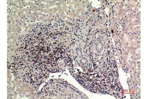 Immunohistochemistry (IHC) analysis of paraffin-embedded Human Liver, antibody was diluted at 1:100. (IFITM1 antibody  (N-Term))