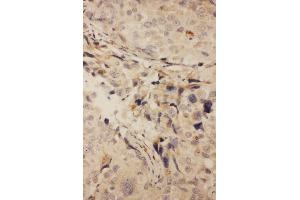 Immunohistochemistry (IHC) image for anti-Tumor Necrosis Factor Receptor Superfamily, Member 11a, NFKB Activator (TNFRSF11A) (AA 29-44), (N-Term) antibody (ABIN3042604)