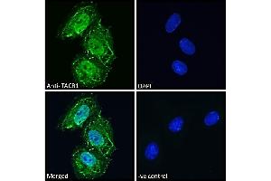 (ABIN190795) Immunofluorescence analysis of paraformaldehyde fixed Neuro2a cells, permeabilized with 0. (TACR1 antibody  (Internal Region))