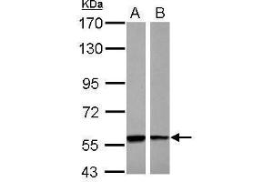 WB Image Sample (30 ug of whole cell lysate) A: A431 B: Raji 7. (PHGDH antibody)