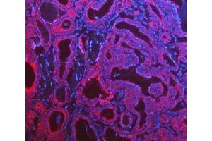IF analysis of Cytokeratin 8/KRT8 using anti-Cytokeratin 8/KRT8 antibody (ABIN5518853). (KRT8 antibody  (AA 107-325))