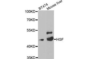 Western blot analysis of extracts of various cell lines, using HGF antibody. (HGF antibody  (AA 30-285))