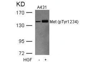 Western blot analysis of extracts from A431 cells untreated or treated with HGF using Met(Phospho-Tyr1234) Antibody. (c-MET antibody  (pTyr1234))