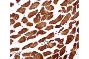 Alpha Actin antibody immunohistochemistry analysis in formalin fixed and paraffin embedded human skeletal muscle