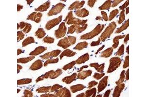 Alpha Actin antibody immunohistochemistry analysis in formalin fixed and paraffin embedded human skeletal muscle (Actin antibody  (AA 346-375))