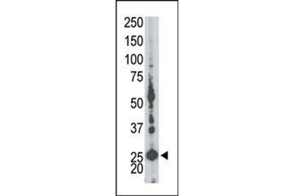 Adenylate Kinase 5 antibody  (N-Term)