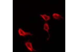 ABIN6278696 staining Hela by IF/ICC. (VZV Protein kinase ORF47 antibody)