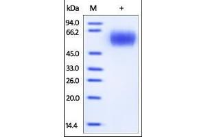 SDS-PAGE (SDS) image for Interleukin 17 Receptor A (IL17RA) (AA 33-320) (Active) protein (His tag) (ABIN2181343)