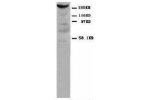 Image no. 1 for anti-Myosin, Light Chain 1, Alkali, Skeletal, Fast (MYL1) antibody (Magnetic Particles) (ABIN1502213)