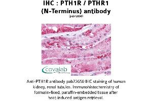 Image no. 1 for anti-Parathyroid Hormone 1 Receptor (PTH1R) (Extracellular Domain), (N-Term), (pThr1) antibody (ABIN1738580) (PTH1R antibody  (Extracellular Domain, N-Term, pThr1))