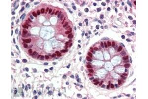 Immunohistochemistry (IHC) image for anti-Early Growth Response 2 (EGR2) (Internal Region) antibody (ABIN334389)