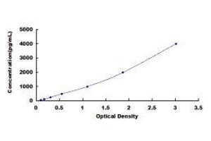 ELISA image for TIMP Metallopeptidase Inhibitor 1 (TIMP1) ELISA Kit (ABIN416002)