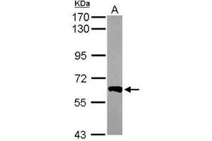 Western Blot analysis: AP19061PU-N PPP3CB antibody staining of Mouse Brain whole cell lysate, 7. (PPP3CB antibody)