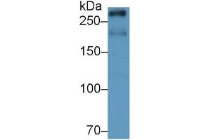 Detection of mTOR in Rat Cerebrum lysate using Monoclonal Antibody to Serine/threonine-protein kinase mTOR (mTOR) (MTOR antibody  (AA 2226-2488))