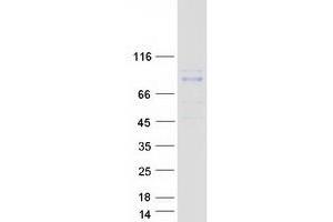 Validation with Western Blot