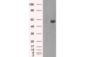Image no. 3 for anti-V-Akt Murine Thymoma Viral Oncogene Homolog 2 (AKT2) antibody (ABIN1496564) (AKT2 antibody)