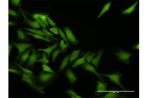 Immunofluorescence of purified MaxPab antibody to PPEF1 on HeLa cell. (PPEF1 antibody  (AA 1-653))