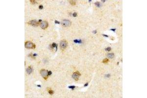 Immunohistochemical analysis of Plasma Kallikrein HC staining in human brain formalin fixed paraffin embedded tissue section. (KLKB1 antibody  (Heavy Chain))