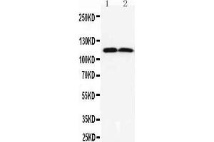 Observed bind size: 114KD (ANO1 antibody  (C-Term))