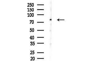 anti-Melanoma Associated Antigen (Mutated) 1 (MUM1) (C-Term) antibody