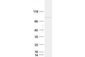 Validation with Western Blot (ELAC2 Protein (Myc-DYKDDDDK Tag))