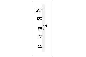 Nephrin  antibody (ABIN654375 and ABIN2844129) western blot analysis in MDA-M cell line lysates (35 μg/lane). (Nephrin antibody  (Tyr1210))