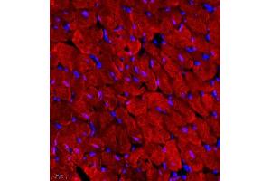 Immunofluorescence of paraffin embedded rat heart using MYL6 (ABIN7074734) at dilution of 1:650 (400x lens) (MYL6 antibody)