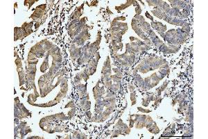 IHC analysis of EXOSC8 using anti-EXOSC8 antibody (ABIN7601850). (EXOSC8 antibody  (AA 49-216))