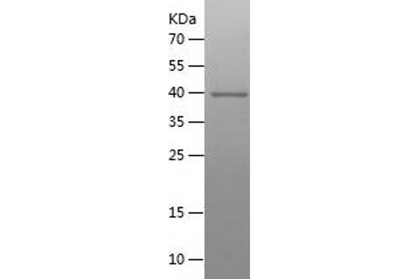 PDIA3 Protein (AA 340-505) (His-IF2DI Tag)