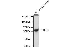 Western blot analysis of extracts of mouse pancreas, using CHID1 antibody (ABIN7266330) at 1:1000 dilution. (CHID1 antibody  (AA 1-393))