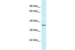 EXOSC9 Antikörper  (N-Term)