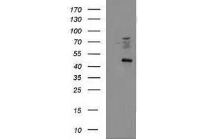 HEK293T cells were transfected with the pCMV6-ENTRY control (Left lane) or pCMV6-ENTRY FDFT1 (Right lane) cDNA for 48 hrs and lysed. (FDFT1 antibody)