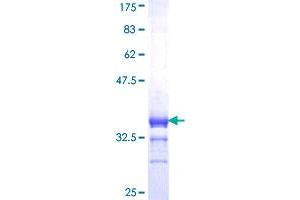 Retinoid X Receptor gamma Protein (AA 1-75) (GST tag)