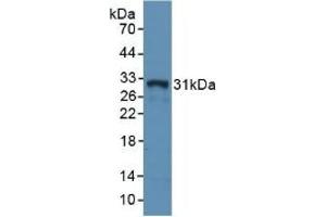 Detection of Recombinant MHCDRa, Rabbit using Polyclonal Antibody to HLA Class II Histocompatibility Antigen, DR Alpha Chain (HLA-DRA) (HLA-DRA antibody  (AA 26-221))