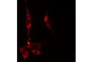 ABIN6274892 staining HeLa cells by IF/ICC. (DDX55 antibody  (Internal Region))