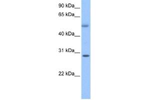 WB Suggested Anti-C17orf81 Antibody Titration: 0. (Retinoic Acid Induced 12 (RAI12) (C-Term) antibody)