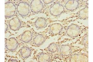 Immunohistochemistry of paraffin-embedded human colon tissue using ABIN7160482 at dilution of 1:100